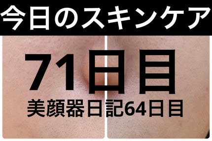 AGE-R ブースタープロ/MEDICUBE/美顔器・マッサージを使ったクチコミ(1枚目)