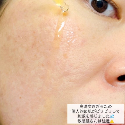 RXã¶ã»ãã¿ãã³C23ã»ã©ã /COSRX/çŸå®¹æ¶²ã䜿ã£ãã¯ãã³ãïŒ6æç®ïŒ