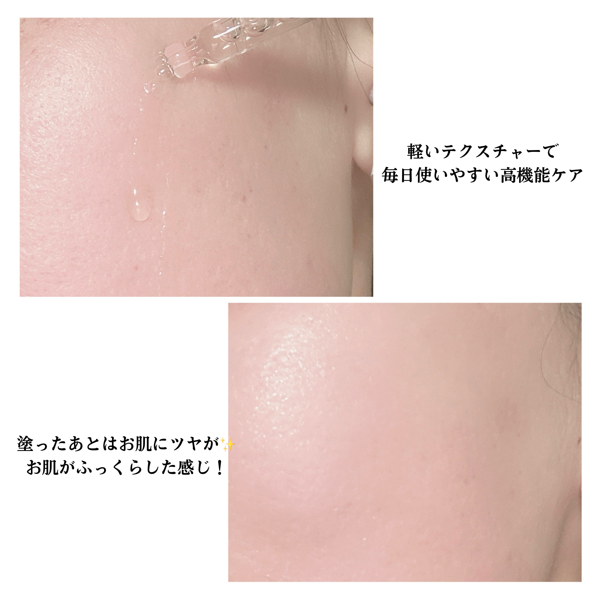 REJURAN ポアタイトニングアンプル 30ml/REJURAN COSMETICS/美容液を使ったクチコミ（3枚目）