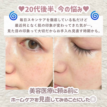 スキンアクト スチーマー マルチ EH-SB50/Panasonic/美顔器・マッサージを使ったクチコミ(3枚目)