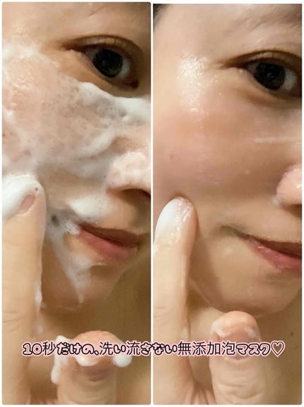 エアバブルCDSマスク/GASH/洗い流すパック・マスクを使ったクチコミ(4枚目)