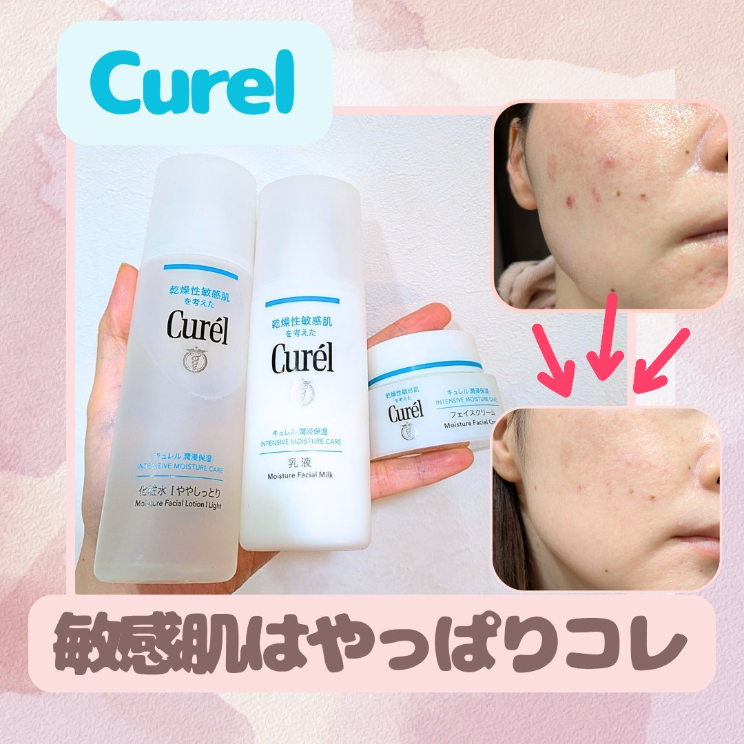 肌の治安を守るなら!!

肌荒れが酷すぎて、敏感肌のスキンケアシリーズに🥺
肌のバリア機能を正常に戻すことから始めようと、高機能のスキンケアや韓国コスメを断ってキュレルを使い始めました❣️


ホルモンバランスや食事、睡眠などの生活習慣も