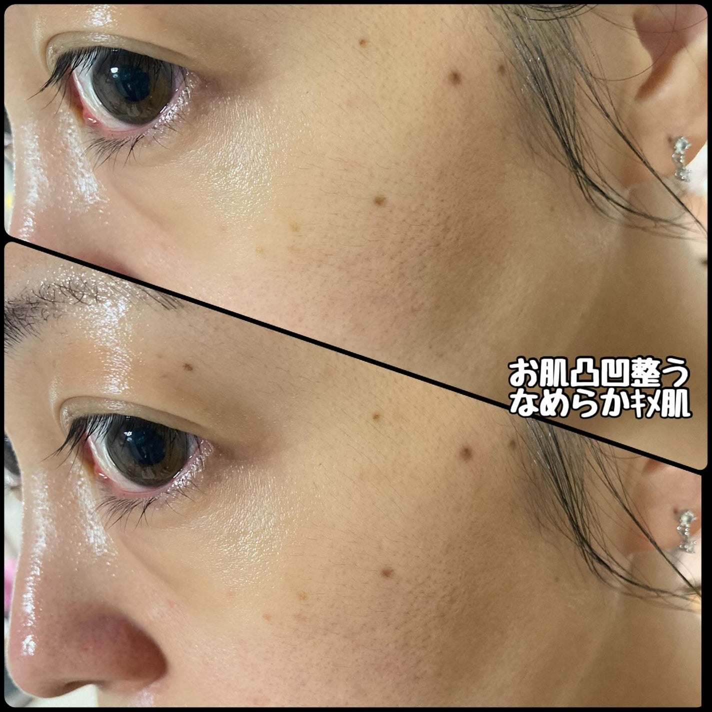 ハトムギナイアシンアミドマスクパック/FULLY/洗い流すパック・マスクを使ったクチコミ(4枚目)