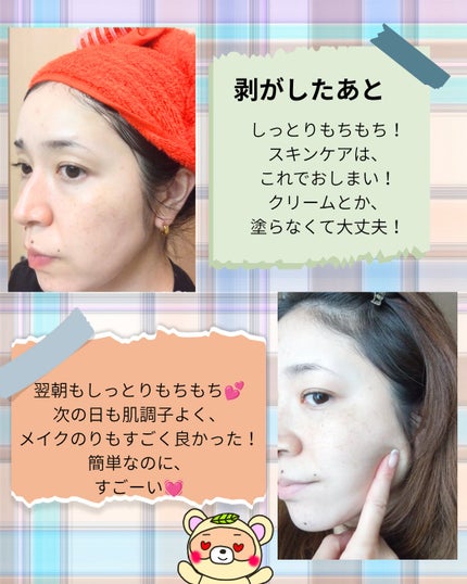 デュイセル プライベートケアマスク/DEWYCEL/シートマスク・パックを使ったクチコミ(5枚目)