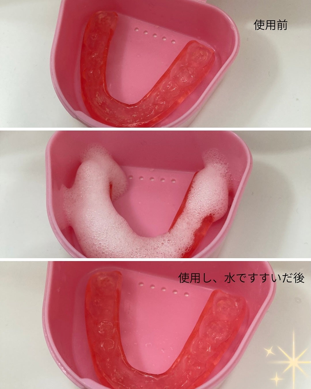 a.sana4374 on LIPS 「ピュオーラ様のプロモーションに参加中寝ている時に歯の食いしばり..」(6枚目)