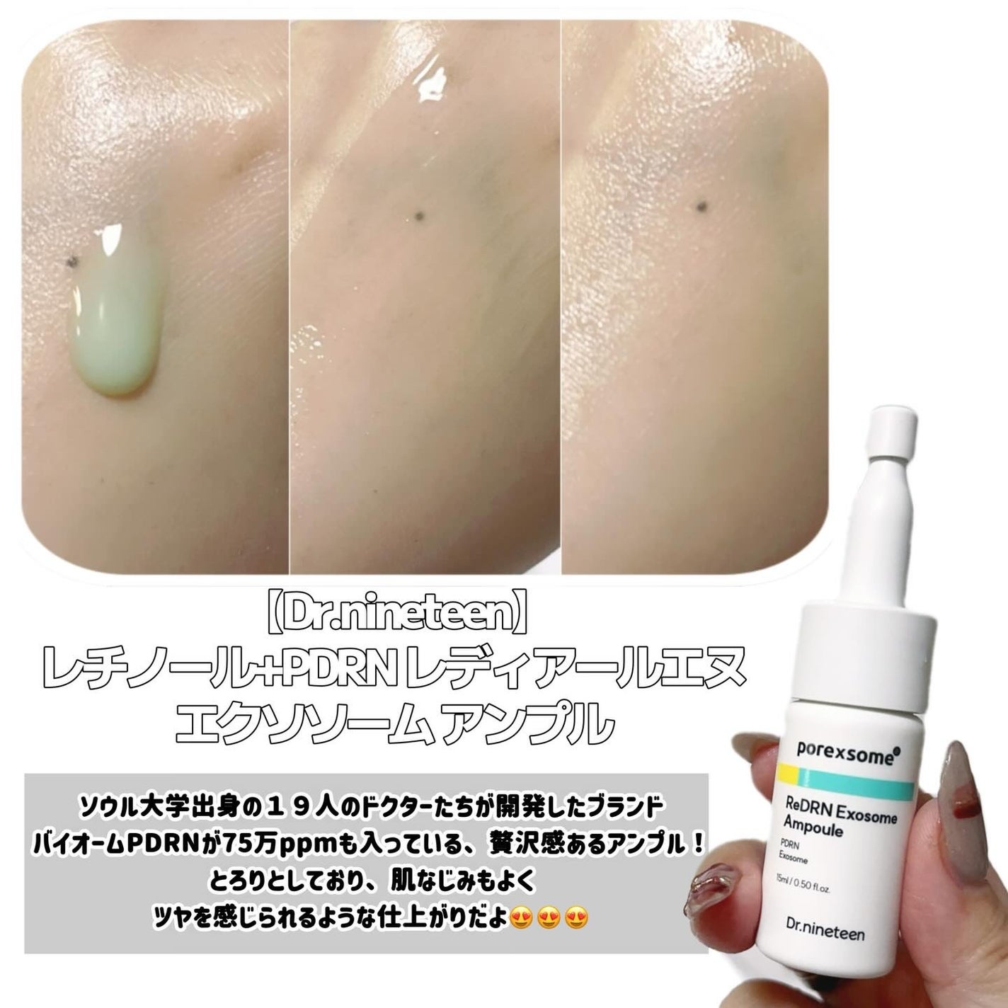 ReDRNエクソソームアンプル/Dr.nineteen/美容液を使ったクチコミ(2枚目)