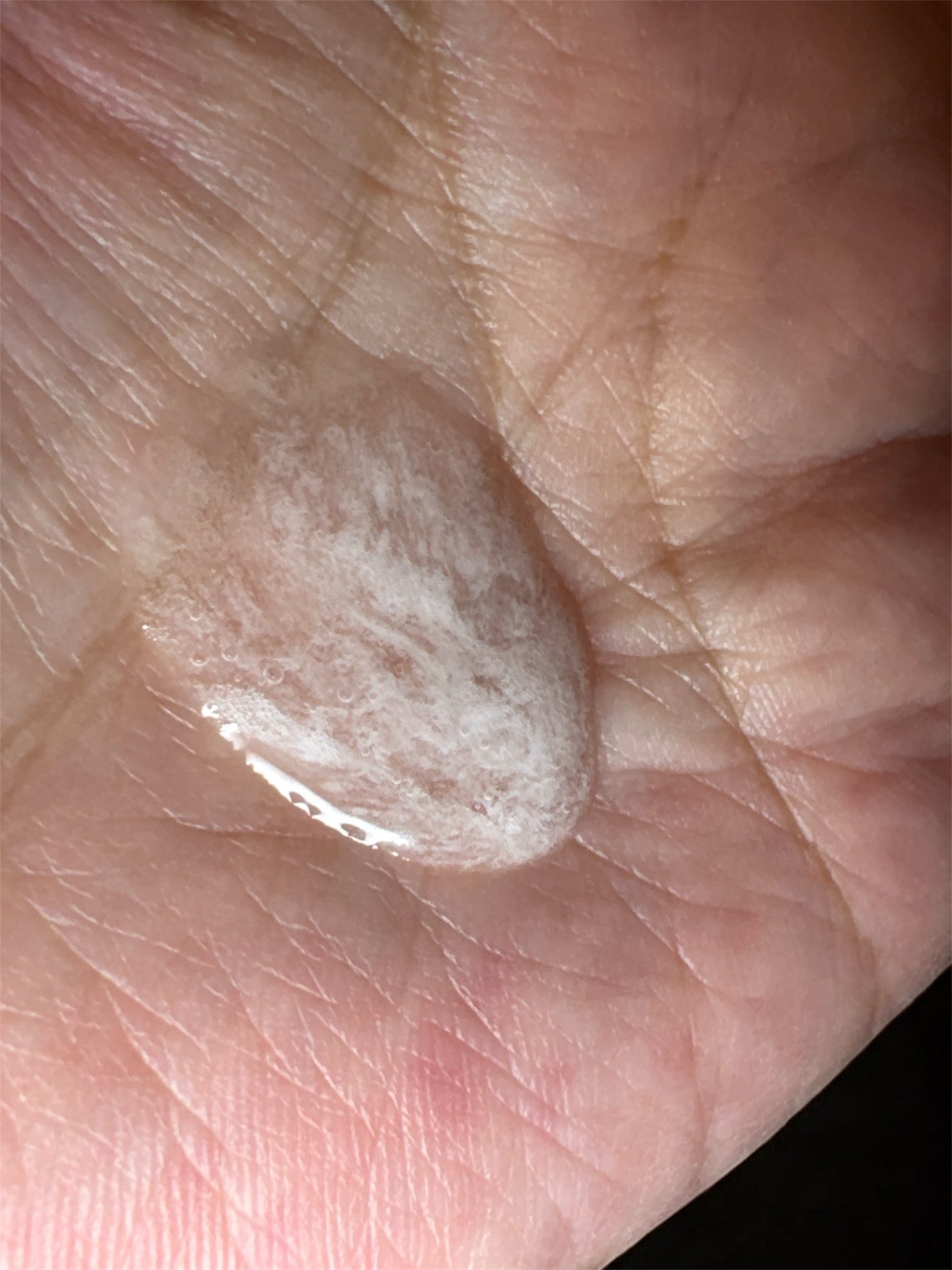 ピュアナチュラルボタニカル ディープスカルプクレンズ/ピュアナチュラル/頭皮クレンジングを使ったクチコミ(4枚目)