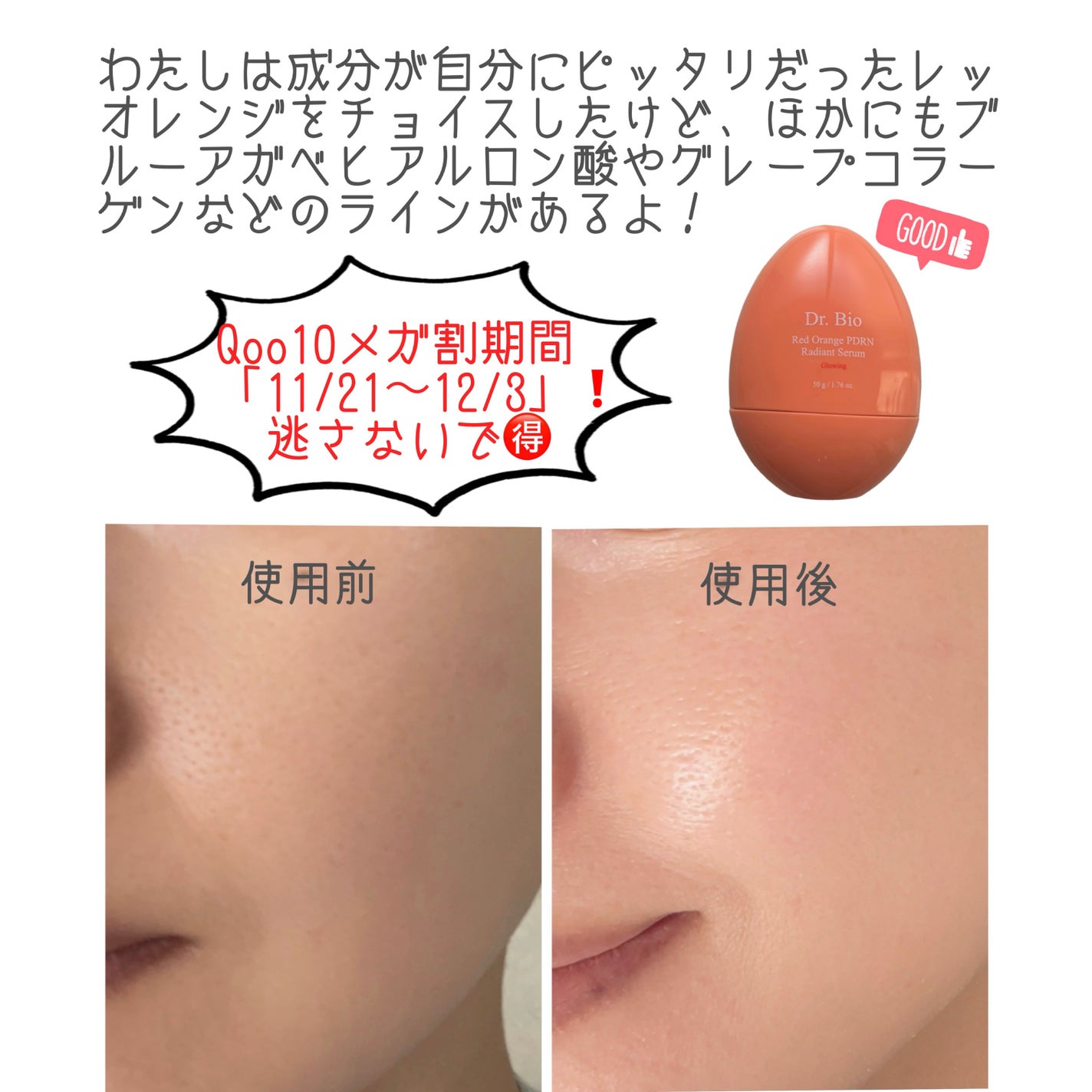 レッドオレンジPDRNセラム/Dr.Bio/美容液を使ったクチコミ(5枚目)
