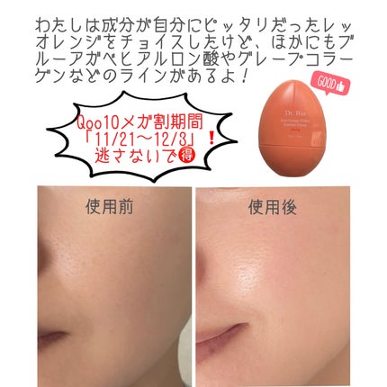 レッドオレンジPDRNセラム/Dr.Bio/美容液を使ったクチコミ(5枚目)