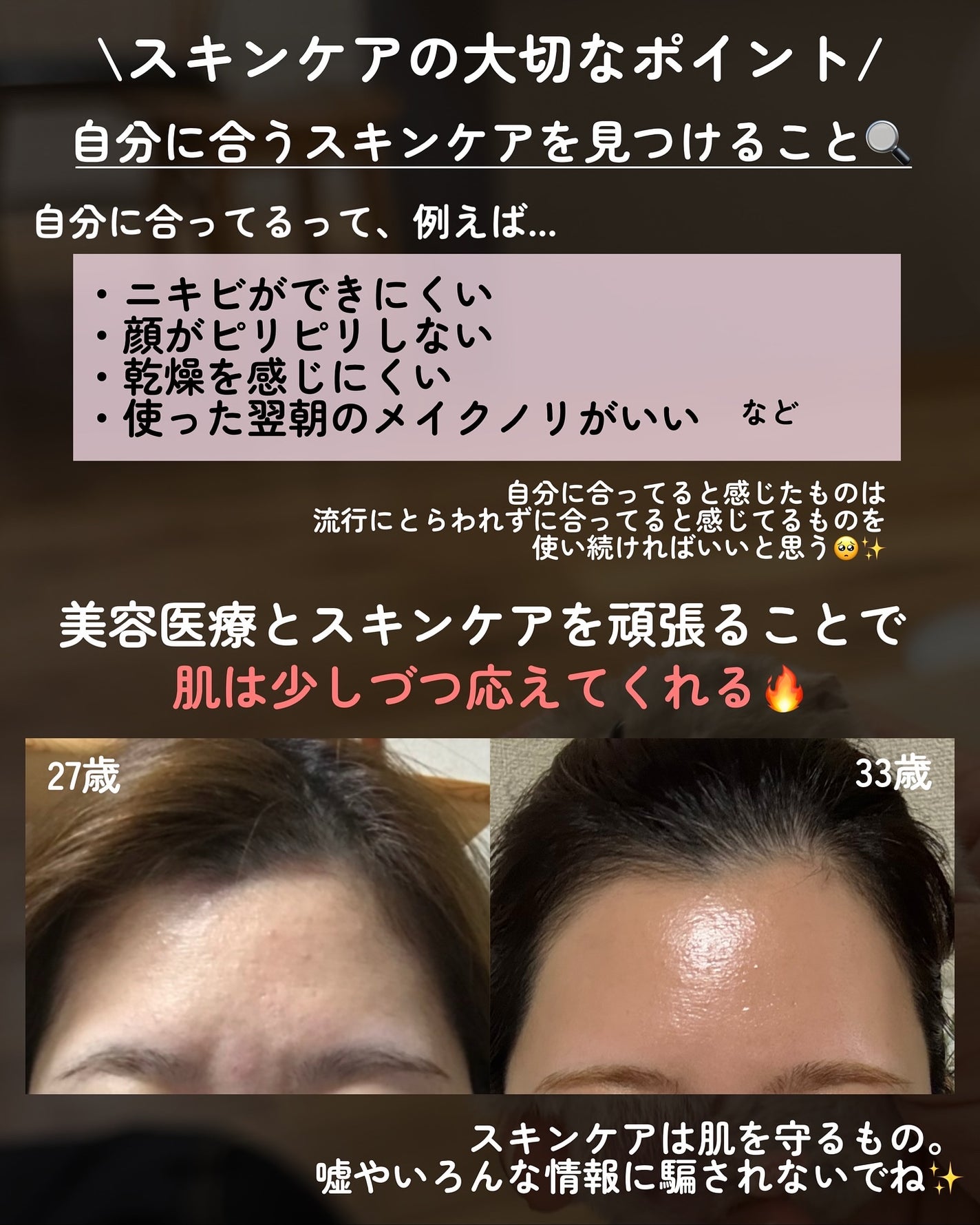 kotori_フォロバ100! on LIPS 「💖スキンケア×美容医療で肌人生が変わった話💖【ガチレポ】で、な..」(9枚目)