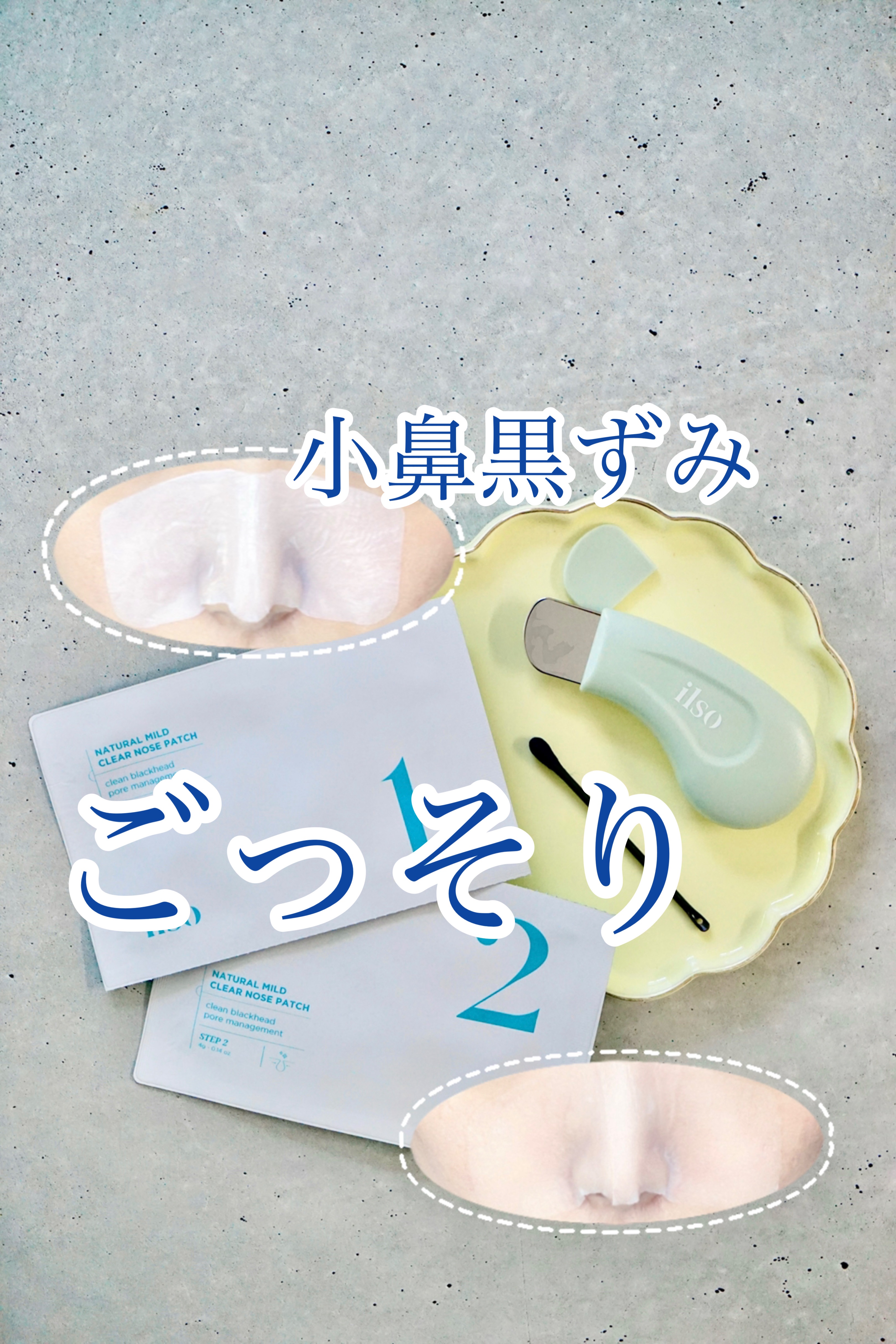 これ凄くないー？？

パックで小鼻まわりの角質を柔らかくして、専用アプリケーターでごっそり💥
きゃー！
恥ずかしいくらいごっそりなんですけど🫣

その後はクールダウンのパックで、しっかりケア♡

ちゃんとケアまでついた1,2ステップのパ