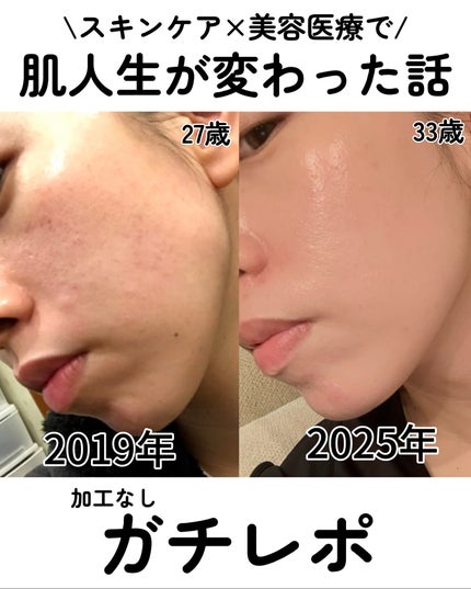 kotori_フォロバ100! on LIPS 「重めでごめんね!でもこれはガチで人生変わった話。27歳→33歳..」(1枚目)