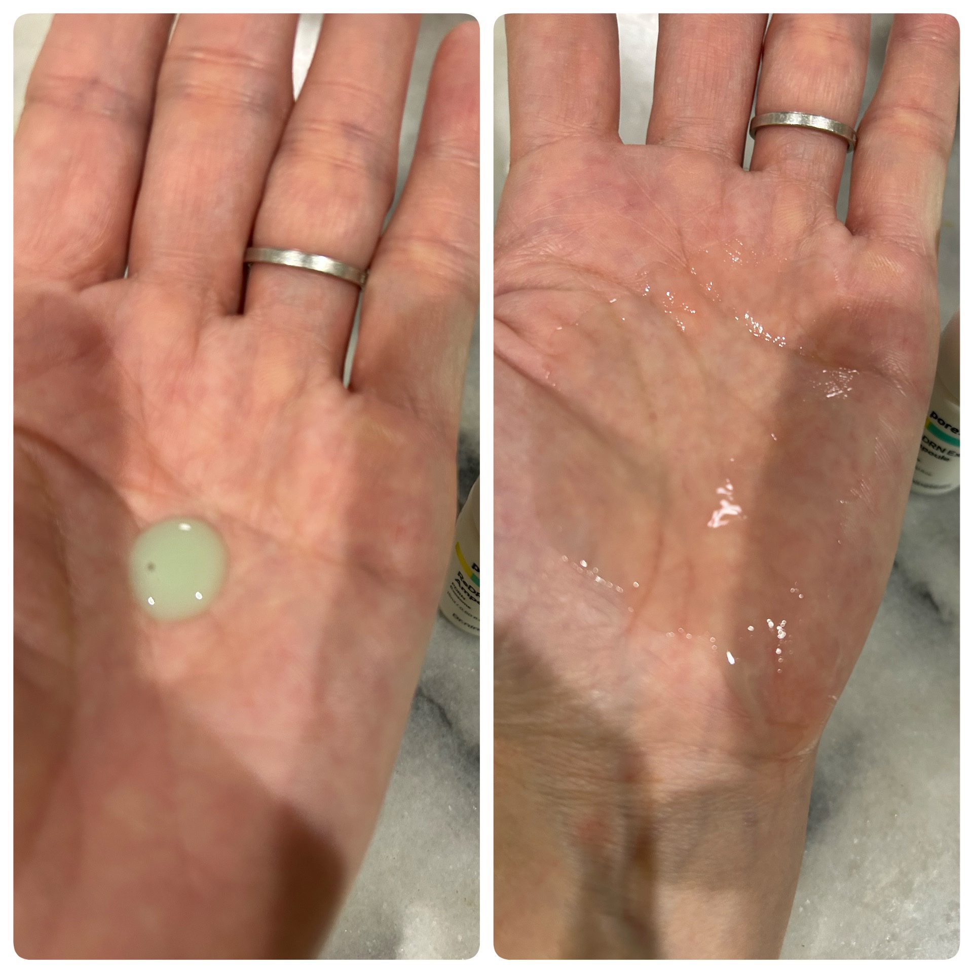 ReDRNエクソソームアンプル/Dr.nineteen/美容液を使ったクチコミ（3枚目）