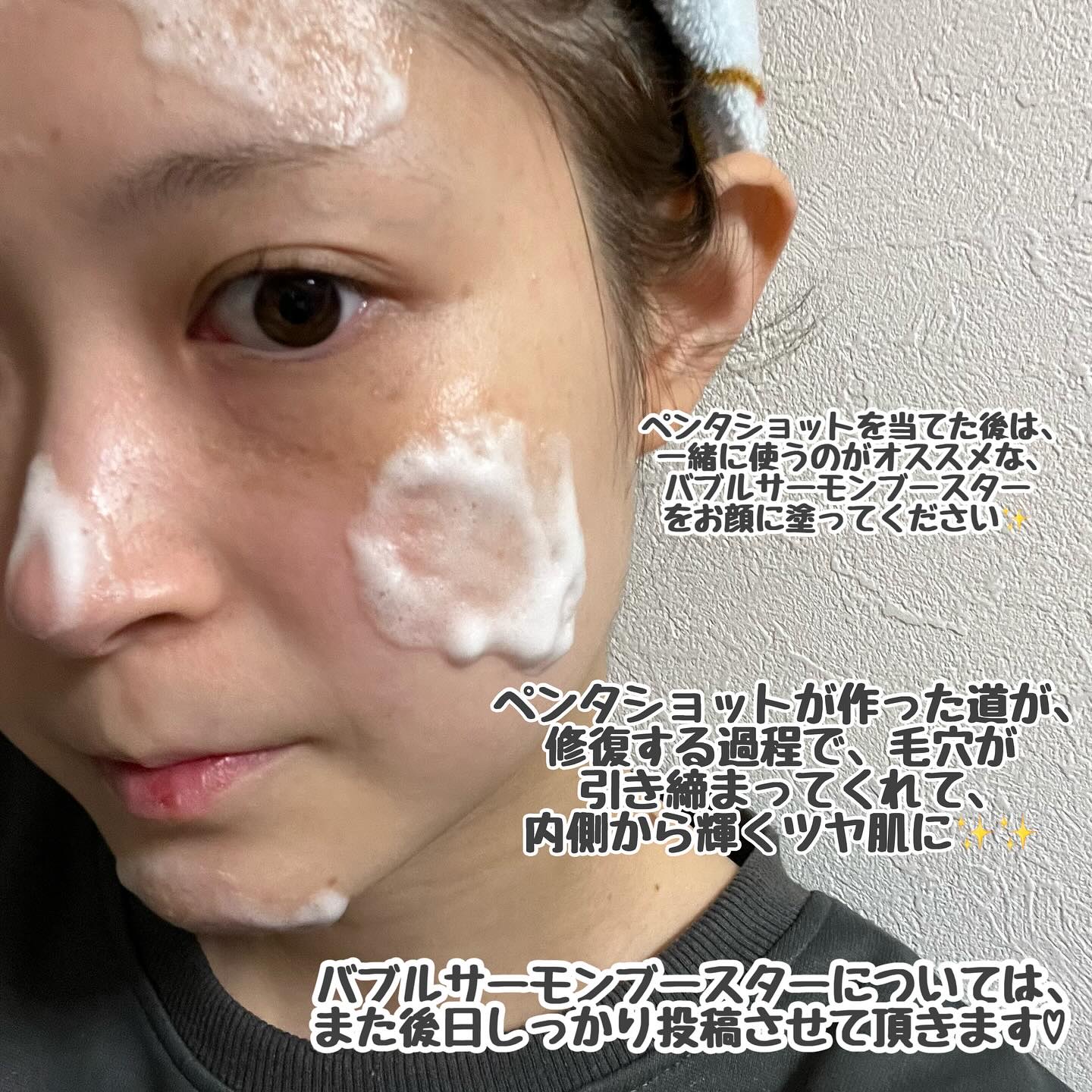 ペンタショット/CELORABY/美顔器・マッサージを使ったクチコミ（3枚目）