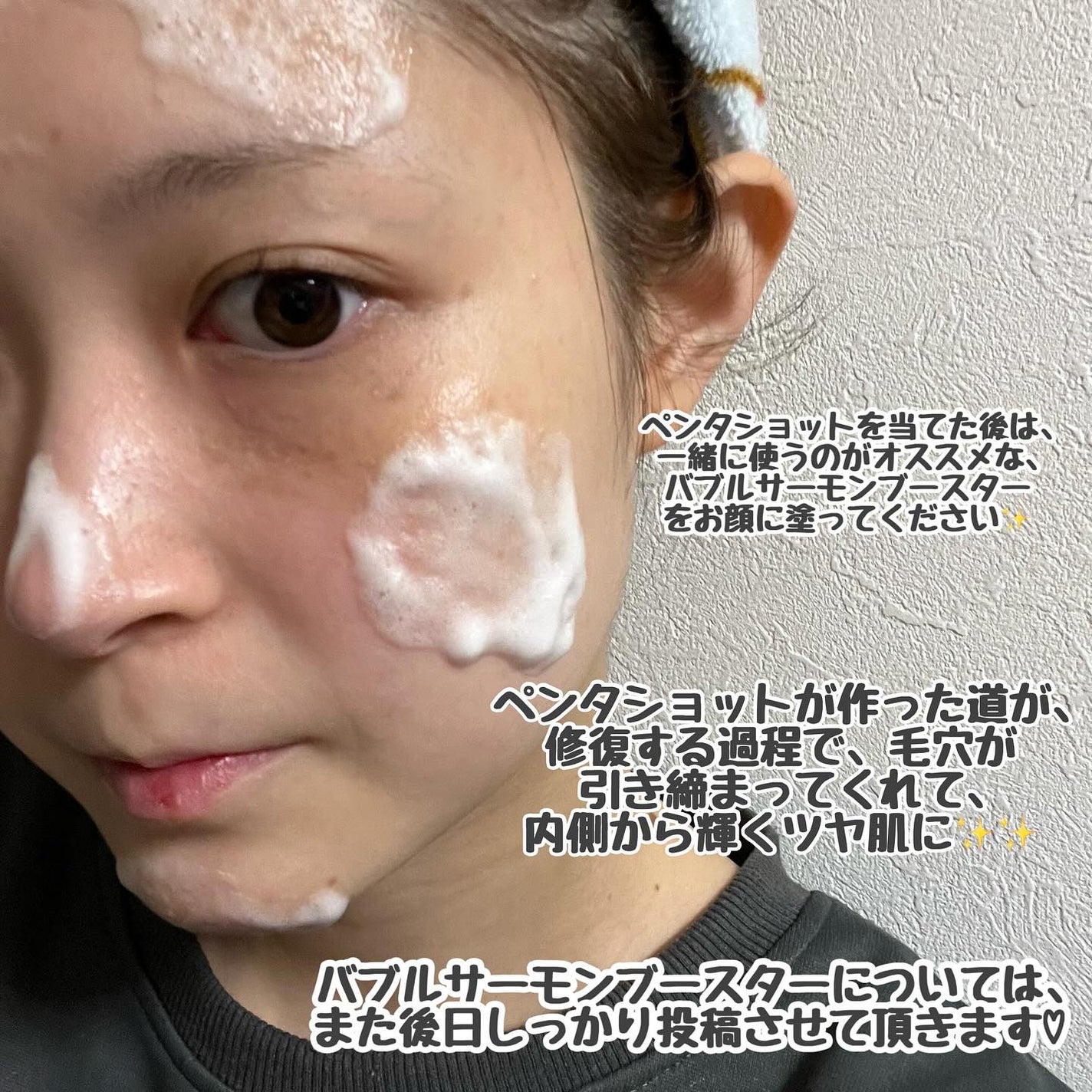 ペンタショット/CELORABY/美顔器・マッサージを使ったクチコミ(3枚目)