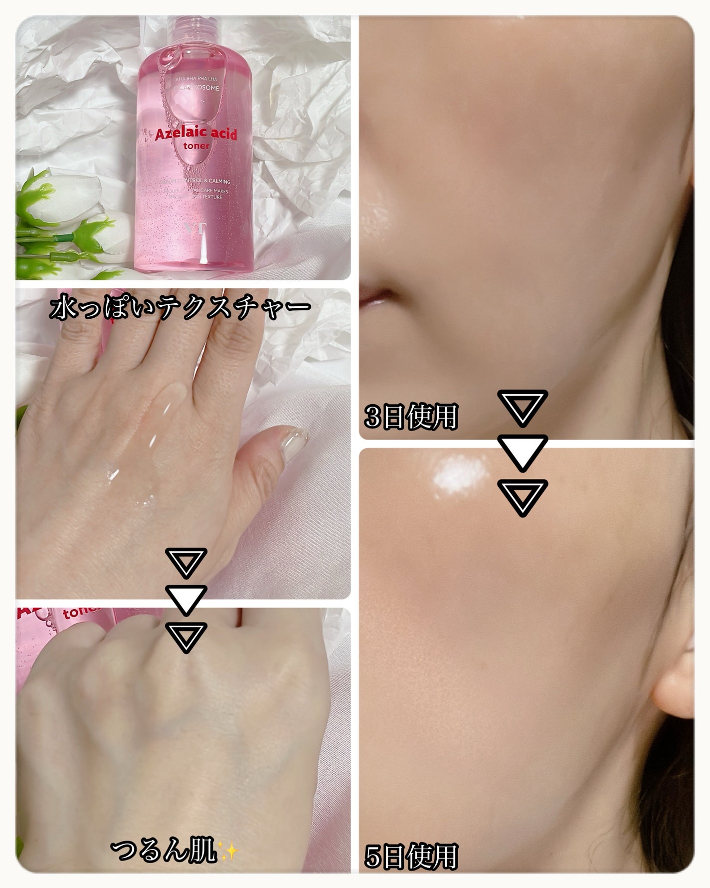 AZケア トナー/VT/化粧水を使ったクチコミ(2枚目)