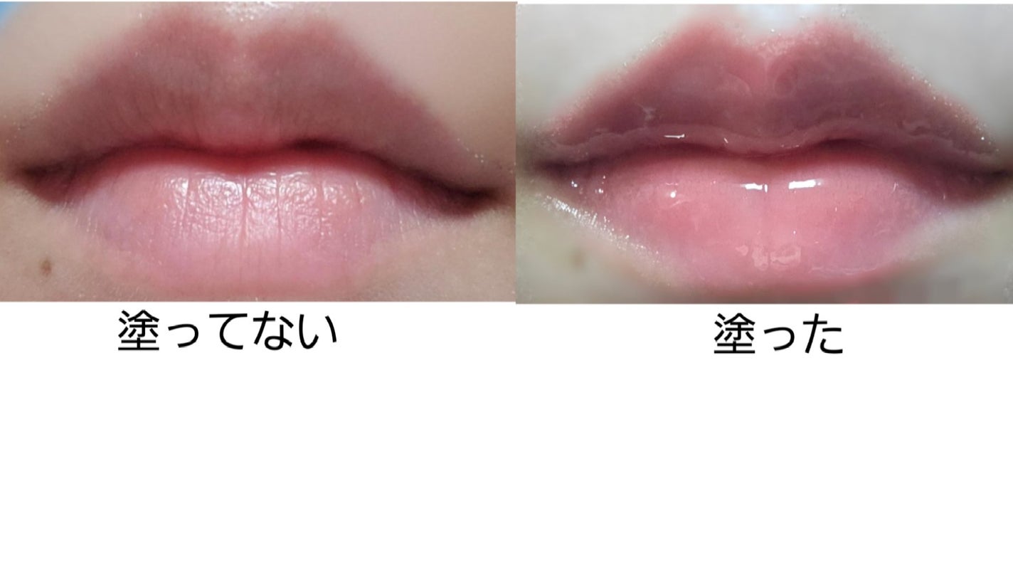 ã°ã¬ãŒãºãªããã»ã©ã /CLIO/ãªããã°ãã¹ã䜿ã£ãã¯ãã³ãïŒ9æç®ïŒ