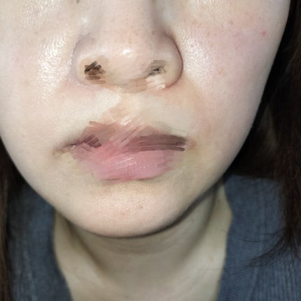 ミノン アミノモイスト モイストチャージ ミルク/ミノン/乳液を使ったクチコミ(3枚目)