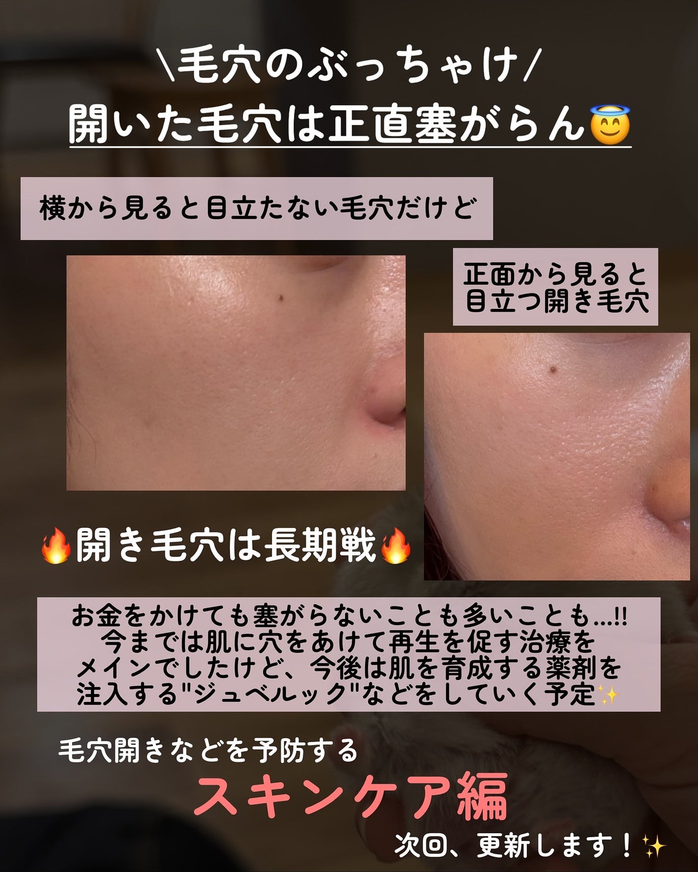 kotori_フォロバ100! on LIPS 「重めでごめんね!でもこれはガチで人生変わった話。27歳→33歳..」(8枚目)