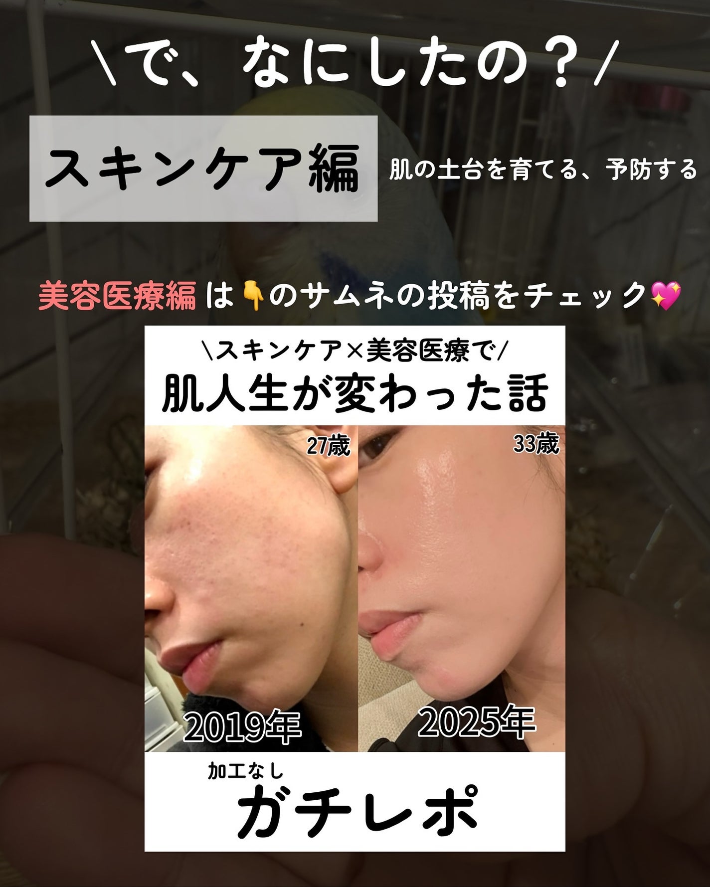 kotori_フォロバ100! on LIPS 「💖スキンケア×美容医療で肌人生が変わった話💖【ガチレポ】で、な..」(3枚目)