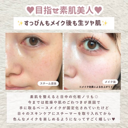 スキンアクト スチーマー マルチ EH-SB50/Panasonic/美顔器・マッサージを使ったクチコミ(6枚目)