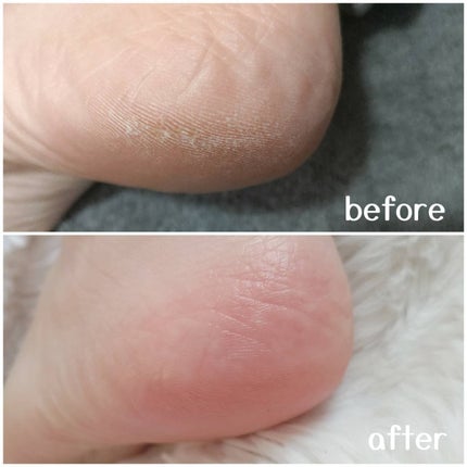 エリィ かかと削り ドッティ/ジュエル・コスメティックス/レッグ・フットケアを使ったクチコミ(3枚目)
