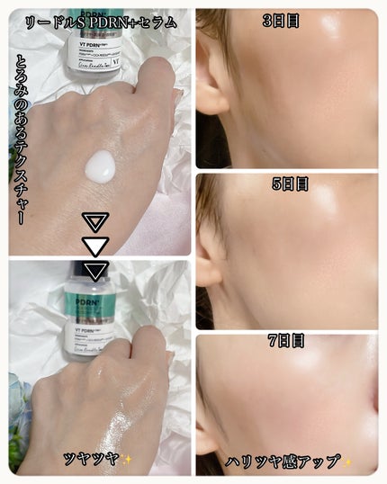 リードルS PDRN+ セラム/VT/美容液を使ったクチコミ(2枚目)