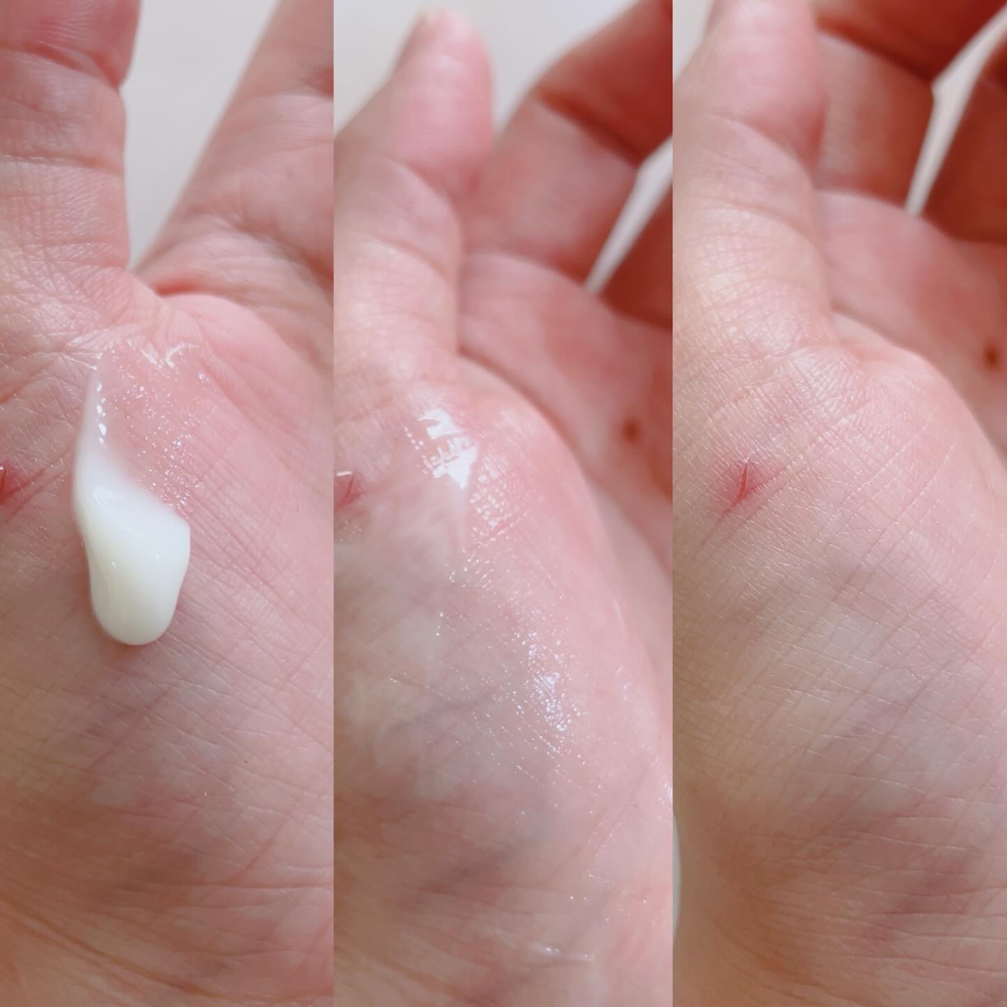 345リリーフクリーム/Dr.Althea/フェイスクリームを使ったクチコミ（2枚目）