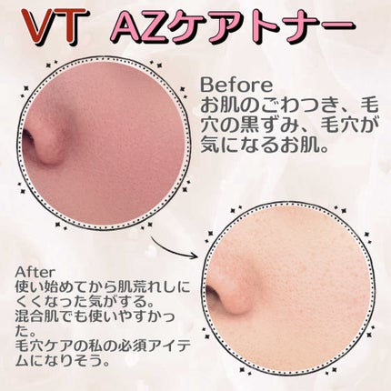 AZケア トナー/VT/化粧水を使ったクチコミ(2枚目)