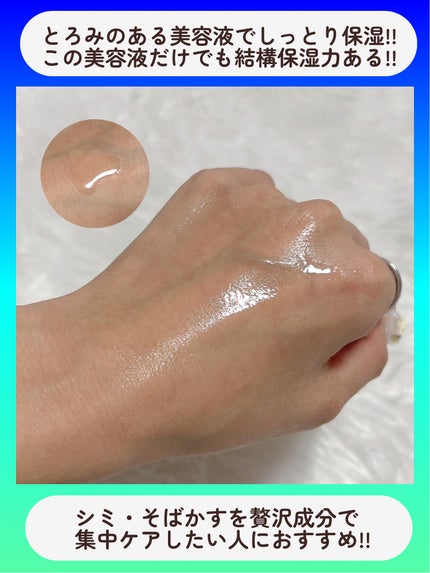 ðŠãããŽãðŠ on LIPS ãã¹ãã·ã£ã«ããã¯ã§ãèãã«ãã«ð//éåœã®ãã¯ã¿ãŒãºã³ã¹ã¡Mi..ãïŒ4æç®ïŒ