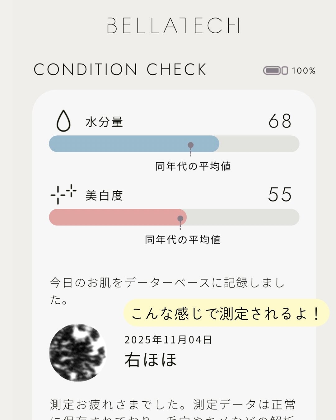 ðððð€ËË on LIPS ãèªåå°çšã¹ãã³ã±ã¢ð±ïŒAIã®è枬å®ã§âä»ã®èç¶æ
âããã§ãã¯..ãïŒ5æç®ïŒ