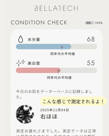 ðððð€ËË on LIPS ãèªåå°çšã¹ãã³ã±ã¢ð±ïŒAIã®è枬å®ã§âä»ã®èç¶æ
âããã§ãã¯..ãïŒ5æç®ïŒ