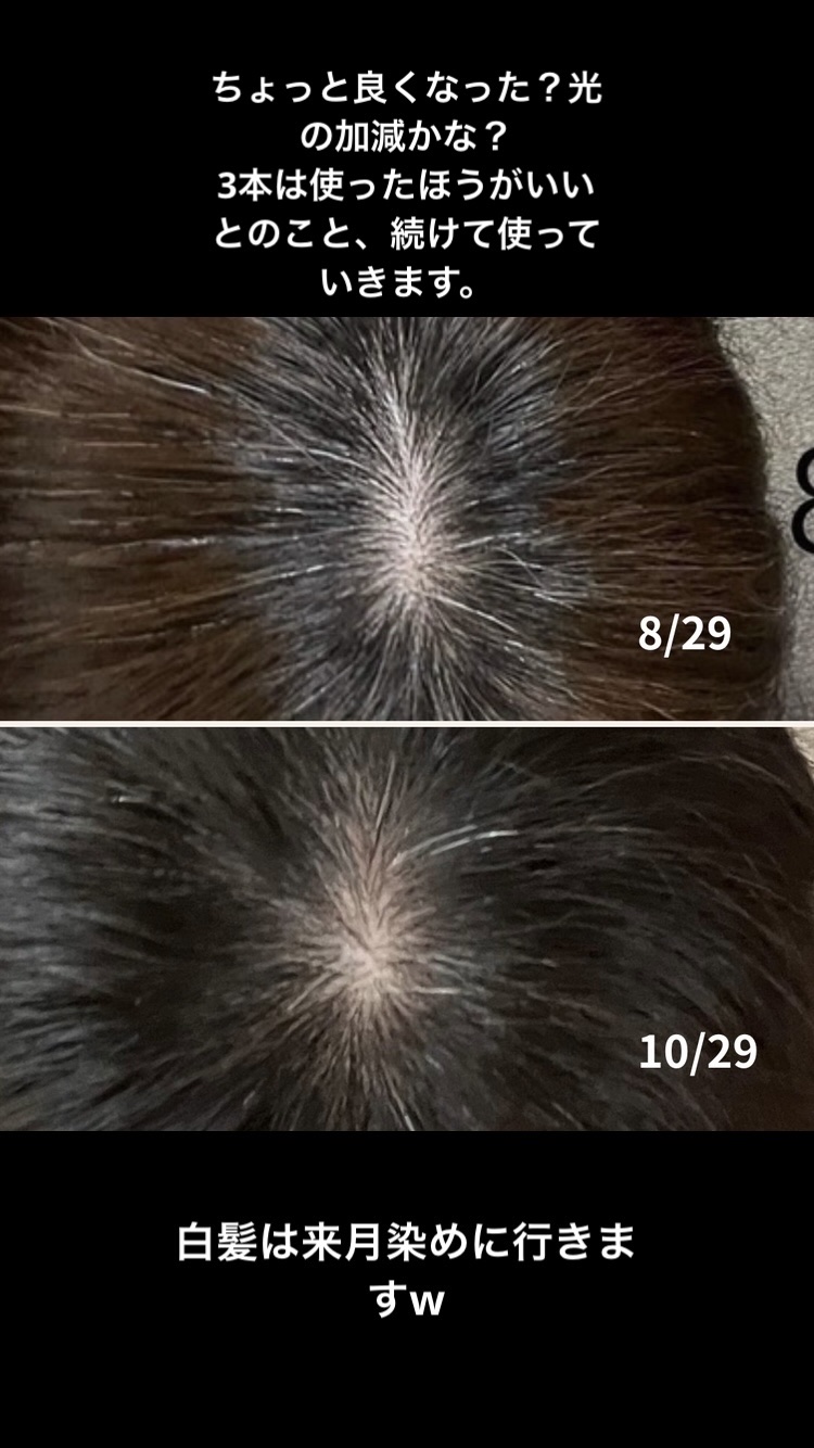 薬用 メディカル アンチヘアロスセラム 50mL/L'OCCITANE/頭皮ローションを使ったクチコミ（2枚目）