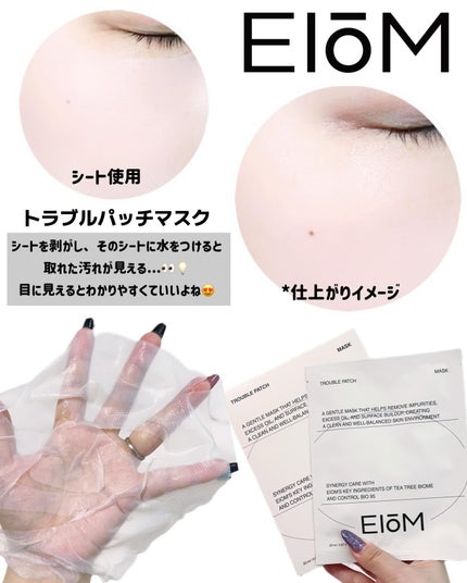 トラブルパッチマスク/EIOM/その他スキンケアを使ったクチコミ(3枚目)