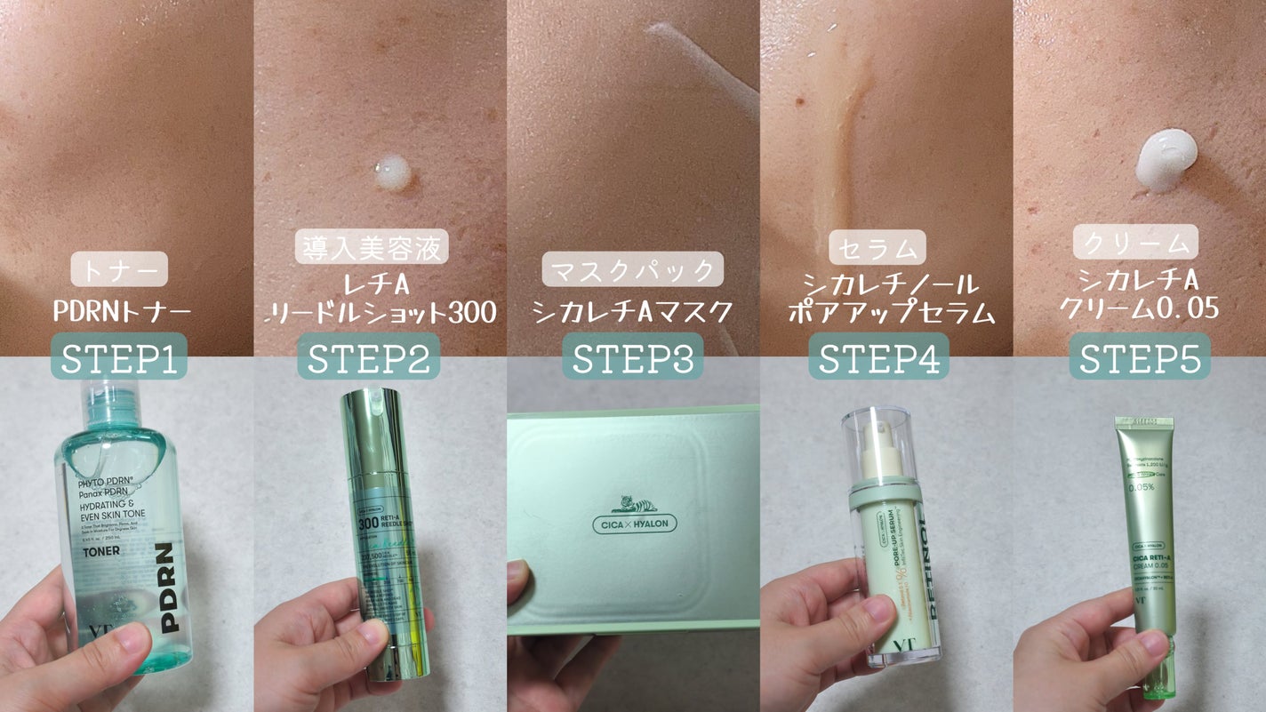 シカレチA クリーム0.05/VT/フェイスクリームを使ったクチコミ(3枚目)