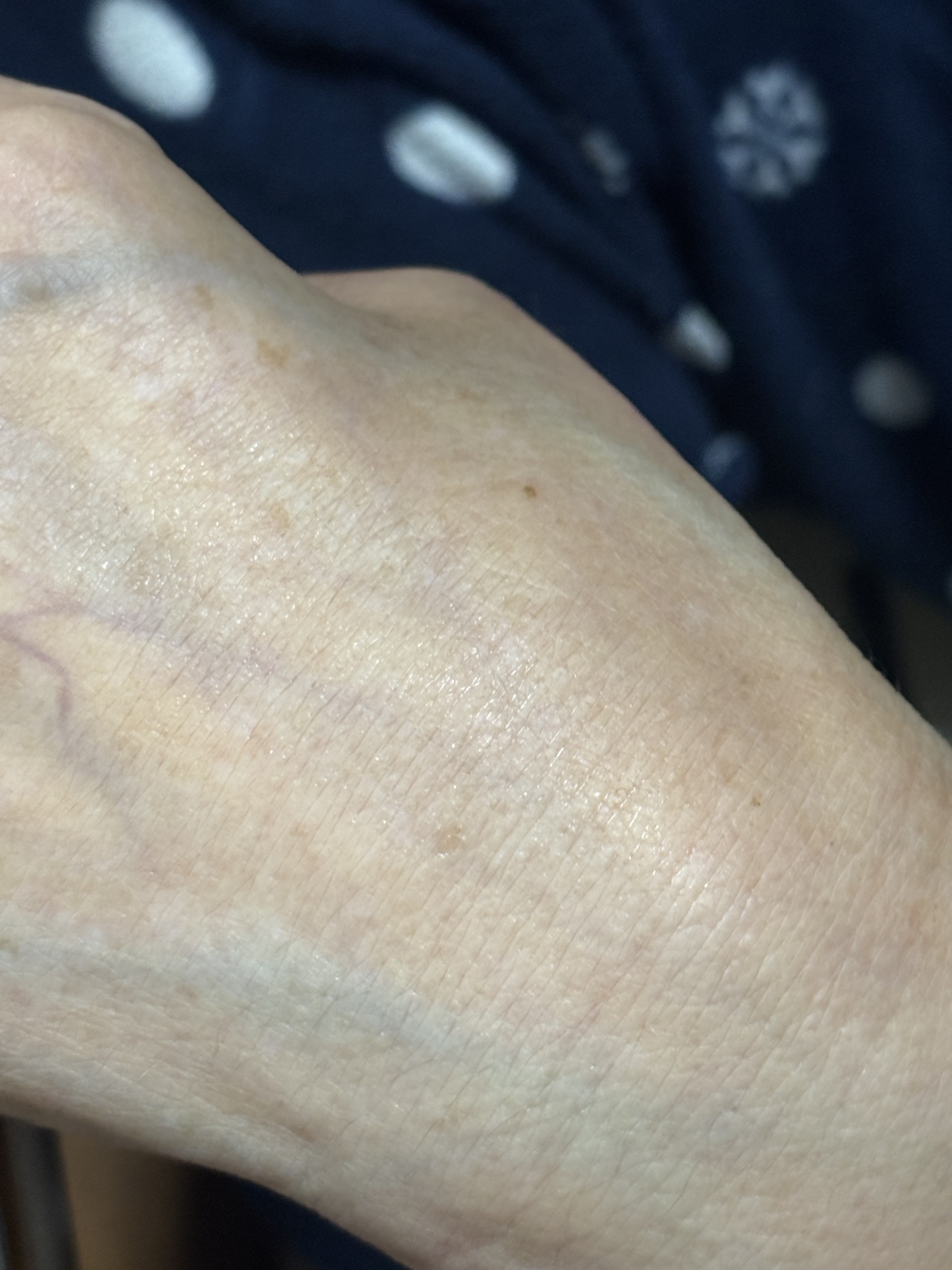 フローリフティングラッピングクリーム/koy/フェイスクリームを使ったクチコミ（3枚目）