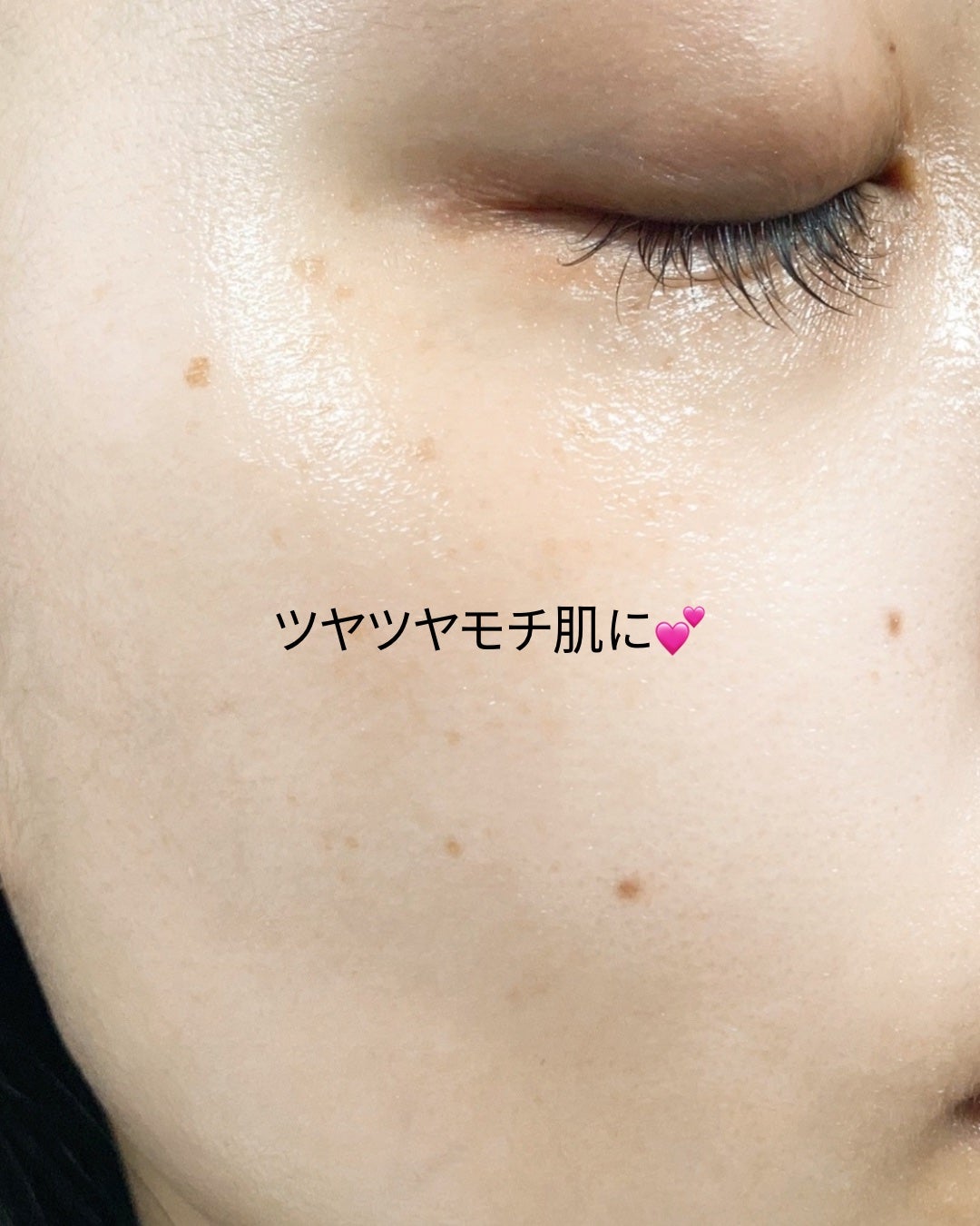 エアバブルCDSマスクU V-アクアボム/GASH/洗い流すパック・マスクを使ったクチコミ(4枚目)