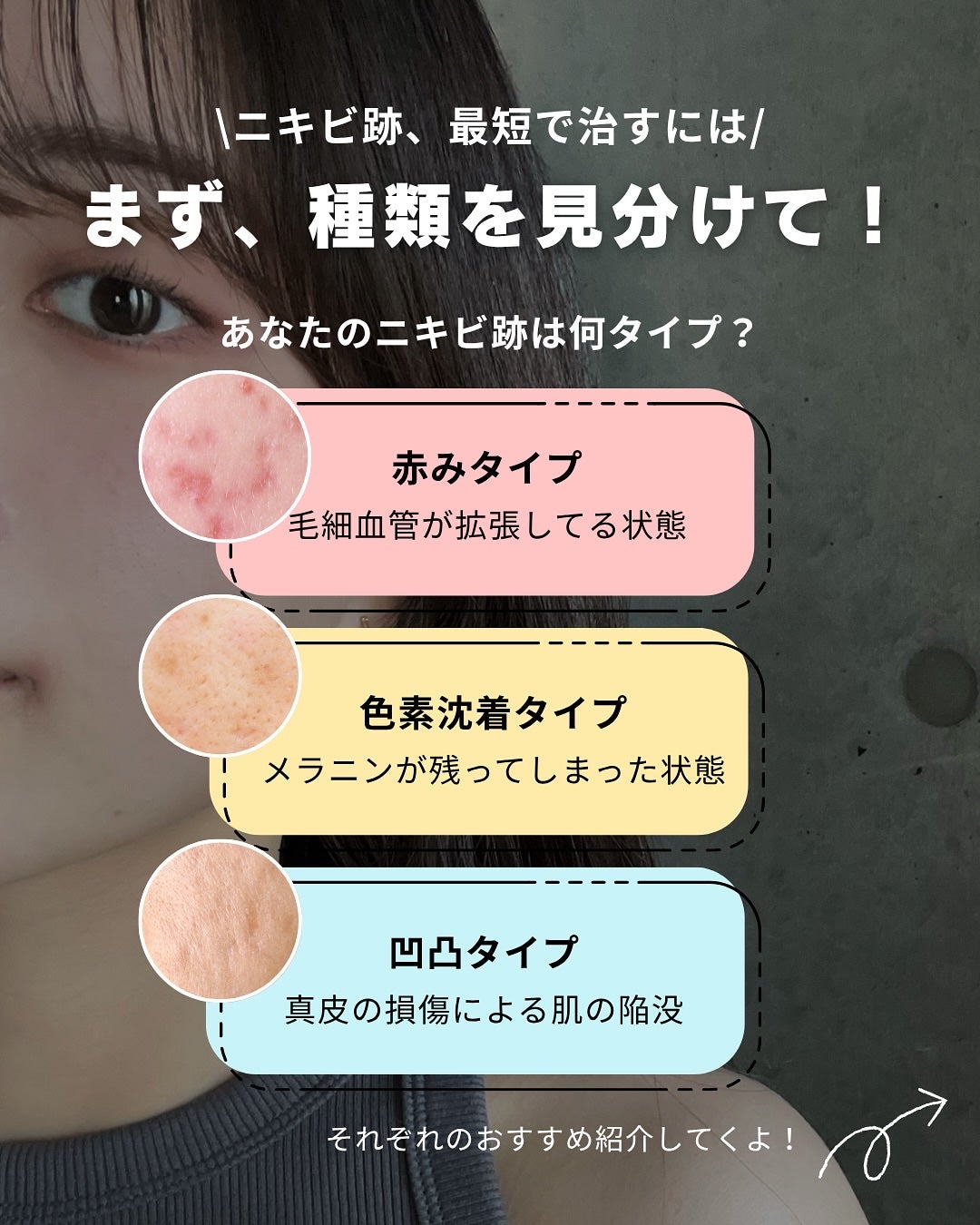 白湯(サユ) | ニキビと戦うOL🤍 on LIPS 「.白湯です!メガ割ニキビ跡まとめ前回かなり好評だったのでNEW..」(2枚目)