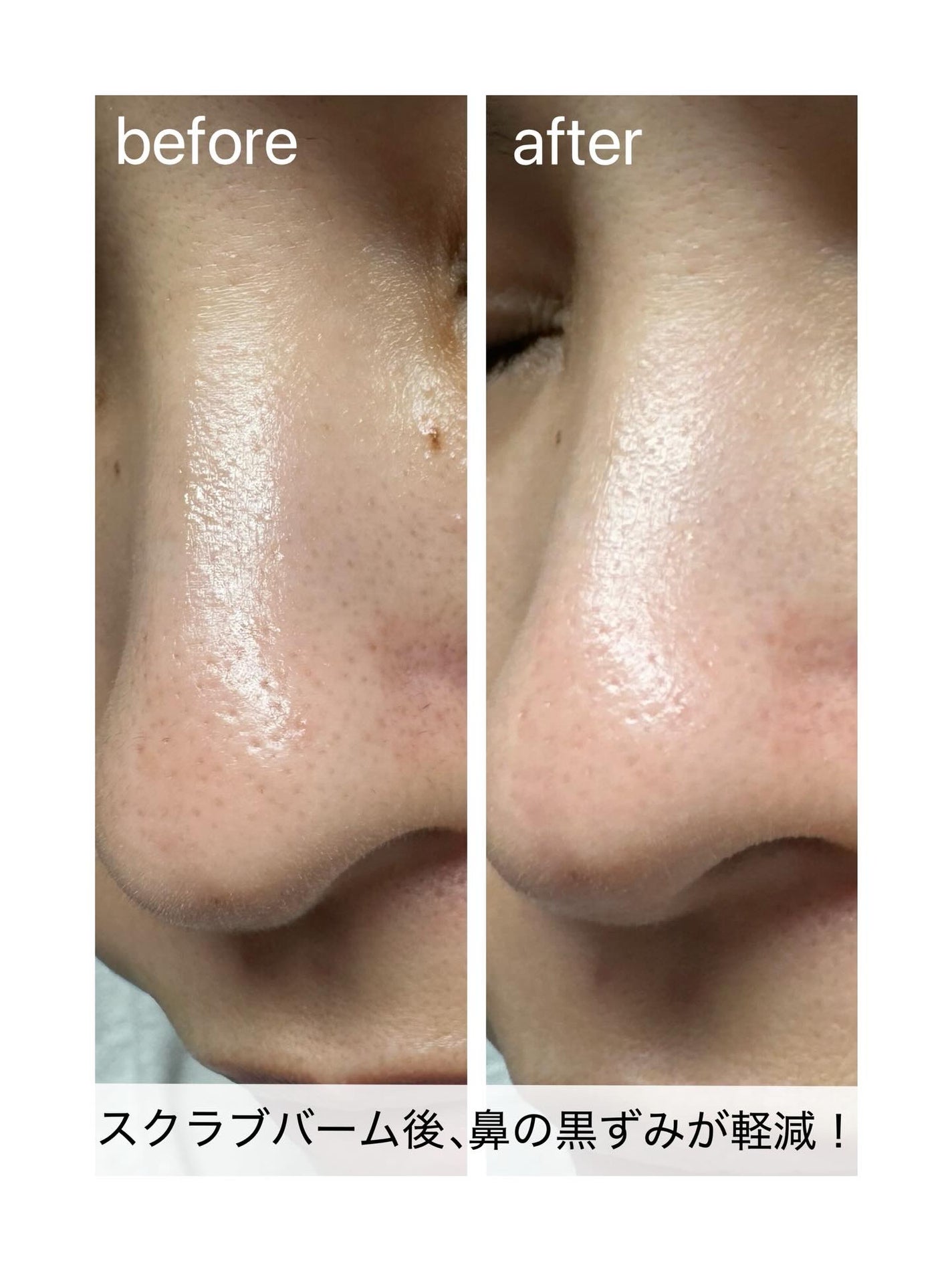 ブラックヘッドバームスクラブ/オブジェ/フェイスバームを使ったクチコミ(6枚目)