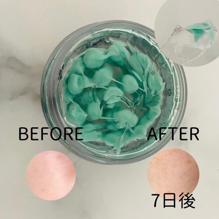 リードルS PDRN+ セラム/VT/美容液を使ったクチコミ(7枚目)