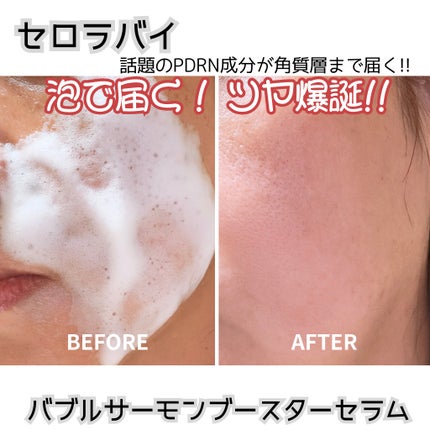 PDRNコラーゲンバブルセラム/CELORABY/美容液を使ったクチコミ(4枚目)