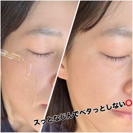 ビタミンC エキスパート25% トーニングアンプル/IOPE/美容液を使ったクチコミ(4枚目)