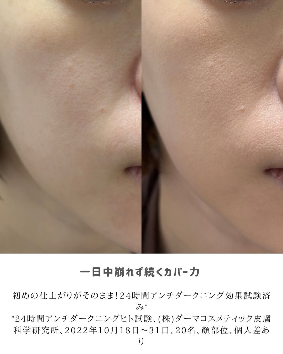 カバーリシャス アルティメット ホワイトクッション/BANILA CO/クッションファンデーションを使ったクチコミ(5枚目)