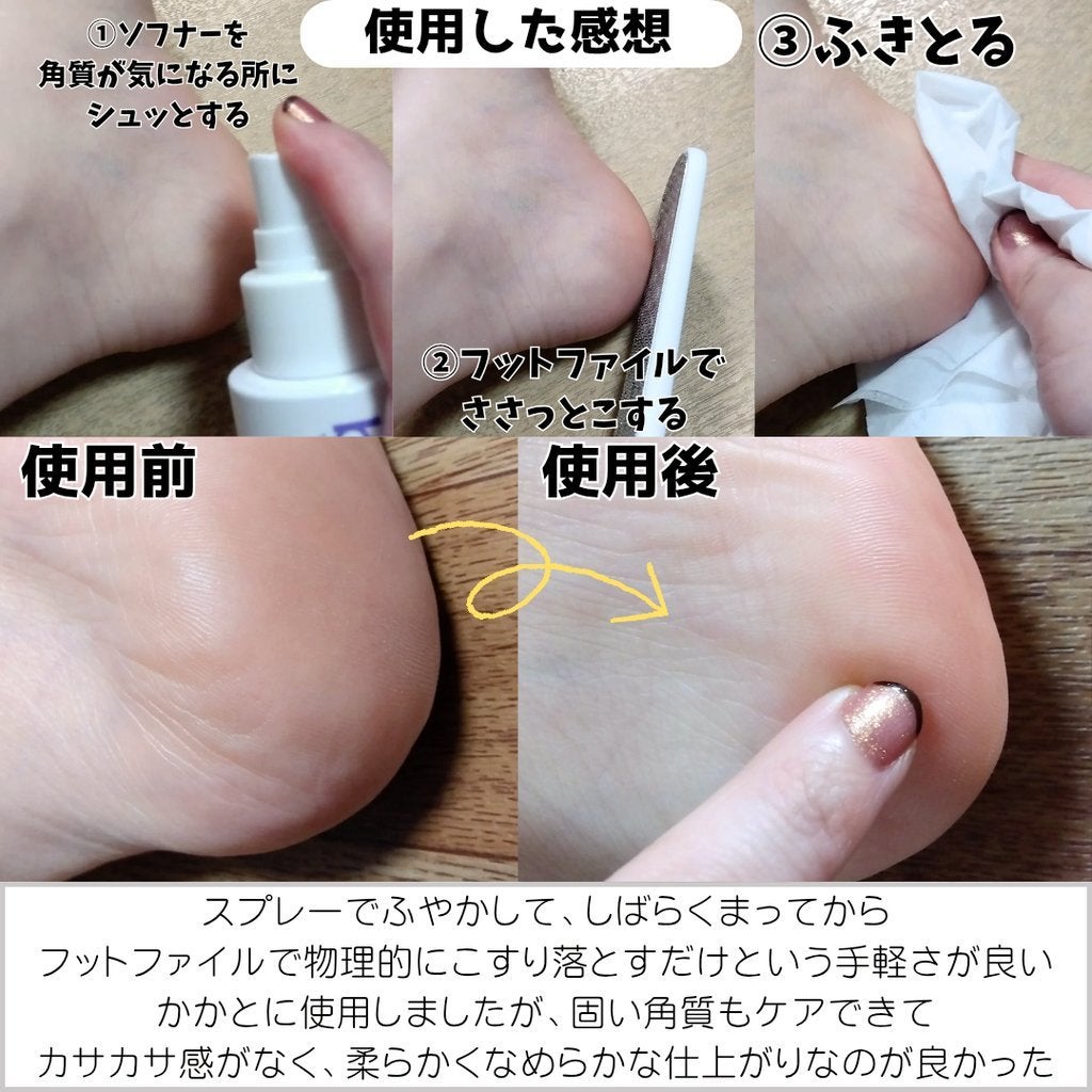 フットケアセット/BAREN/その他キットセットを使ったクチコミ(4枚目)