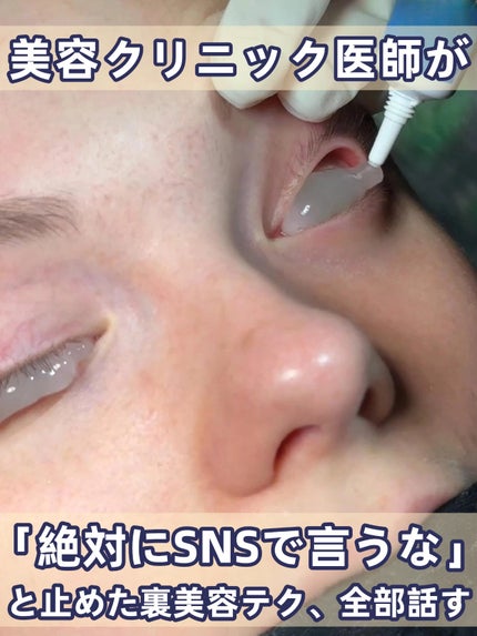 アネトス バランシング トリートメントクリーム/Anetos/フェイスクリームを使ったクチコミ(1枚目)