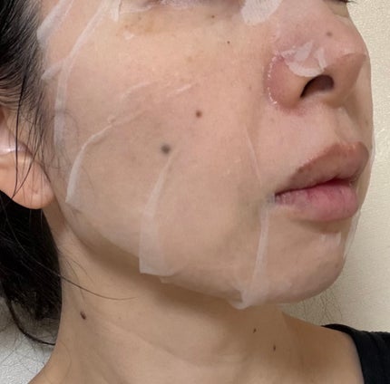 ドクダミシートマスクデイリーピック/Abib /シートマスク・パックを使ったクチコミ(4枚目)