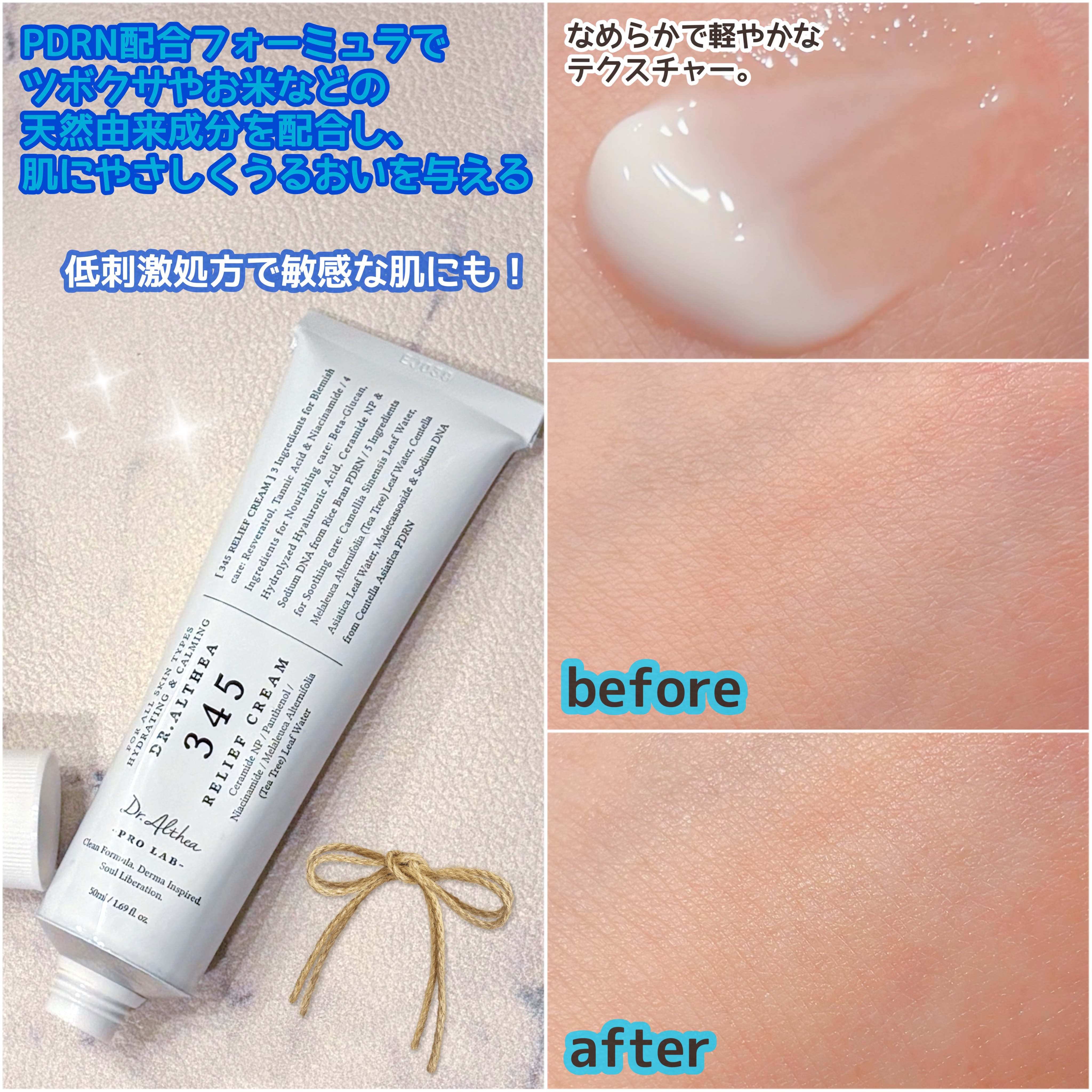 345リリーフクリーム/Dr.Althea/フェイスクリームを使ったクチコミ（2枚目）