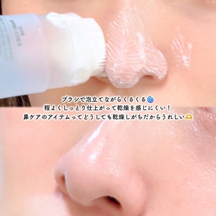 ãœããð¶ãã©ããâ on LIPS ããã©ãã¯ããããè§è³ªãããã1æ¬ã§ç°¡åã±ã¢âšåŸ®çްã¹ã¯ã©ãÃã·ãª..ãïŒ3æç®ïŒ