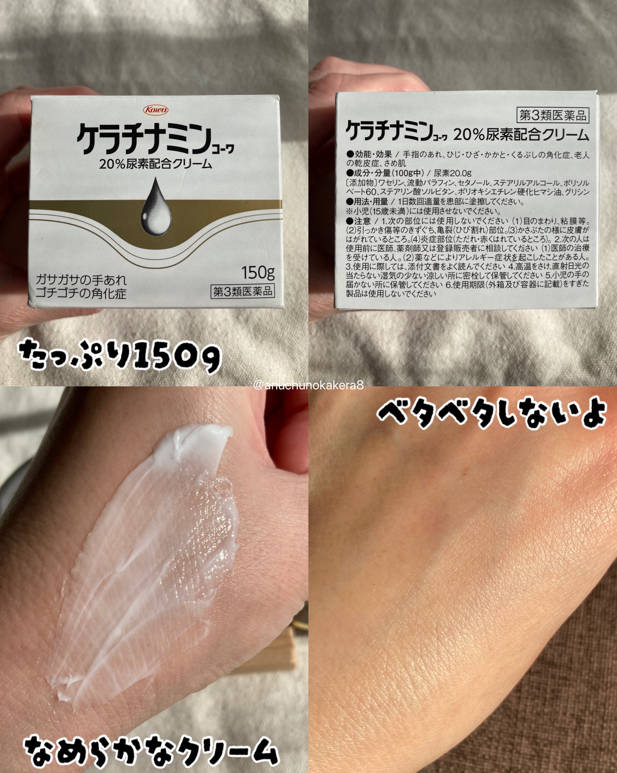 コーワ20％尿素配合クリーム(医薬品)/ケラチナミン/その他を使ったクチコミ（3枚目）