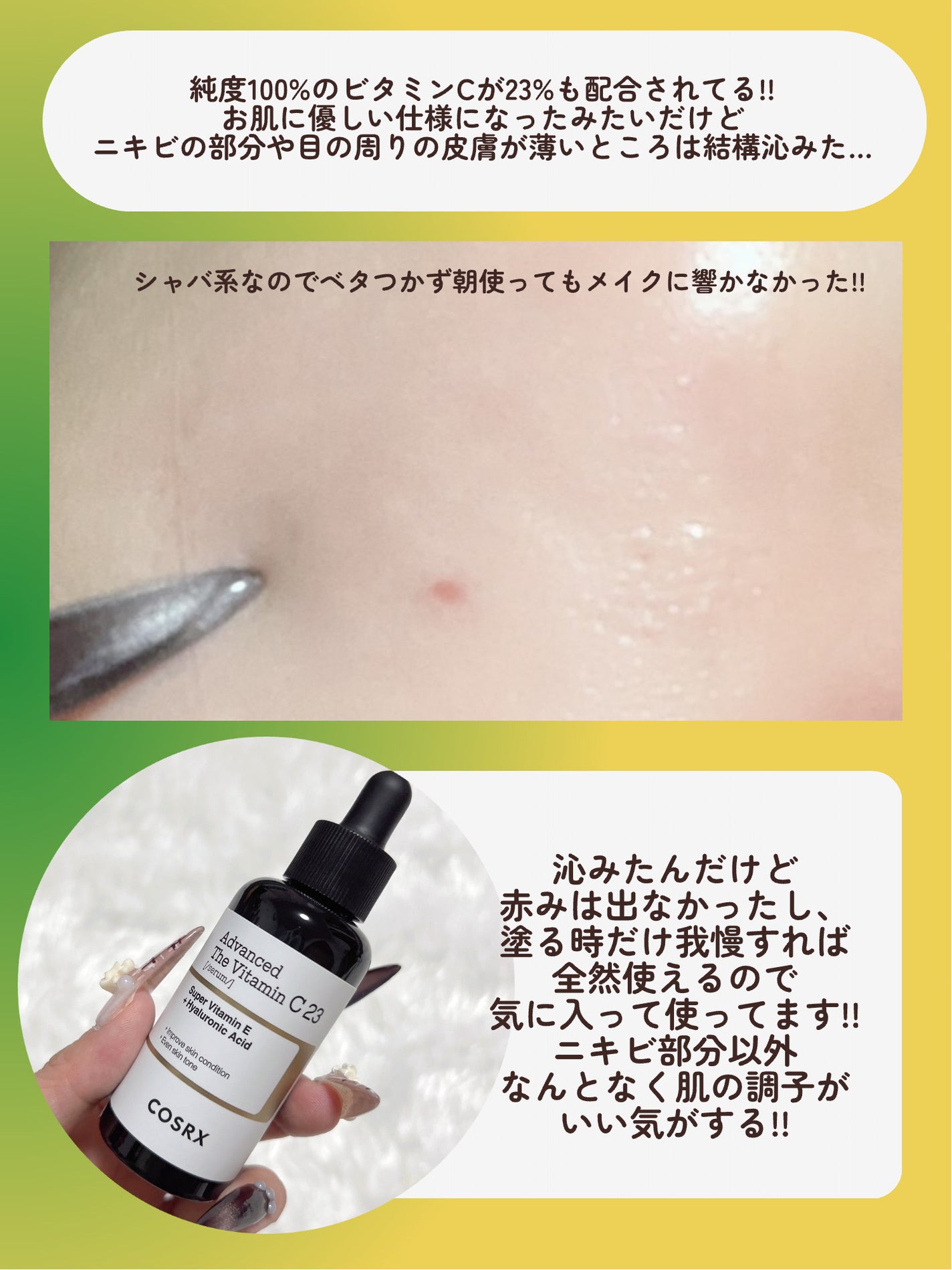 RXã¢ããã³ã¹ã ã¶ã»ãã¿ãã³C23ã»ã©ã /COSRX/çŸå®¹æ¶²ã䜿ã£ãã¯ãã³ãïŒ5æç®ïŒ